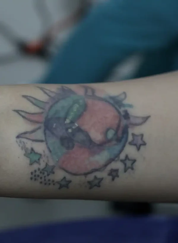 Seminario eliminacion de tatuajes foto 9